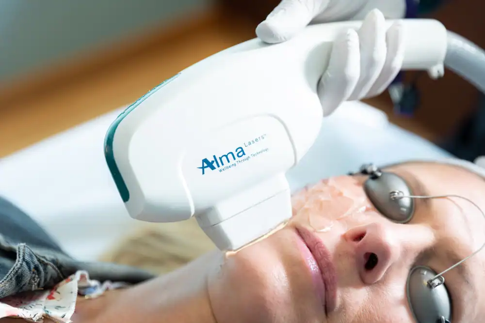 Alma-Laser
