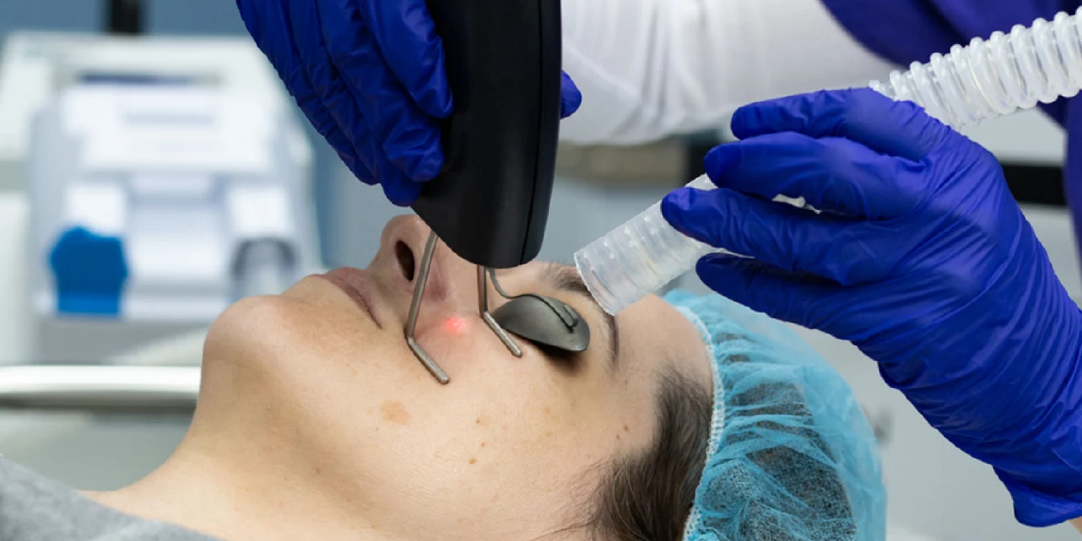 Why High-Quality Laser Consumables Matter